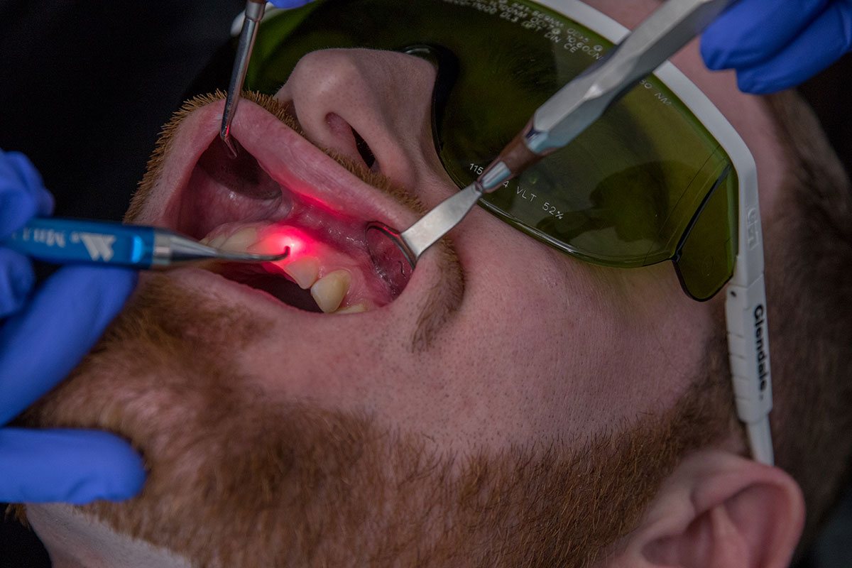 laser gum surgery tx longview disease periodontist